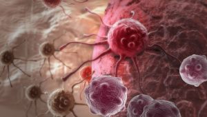 Krebszellen, Fotoquelle: 123RF