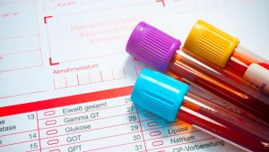 Cholesterinwerte regelmÃ¤ÃŸig untersuchen lassen, Fotoquelle: Fotolia