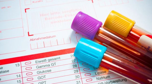 Cholesterinwerte regelmÃ¤ÃŸig untersuchen lassen, Fotoquelle: Fotolia