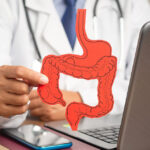 Chronische Darmentzündung: Morbus Crohn