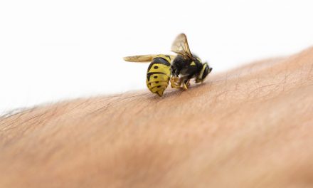 Insektenstich: Was hilft gegen Juckreiz und Schwellung?