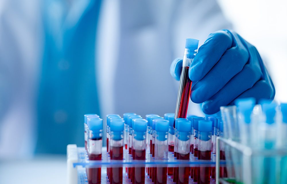 Worauf Patienten bei einer Blutanalyse achten müssen