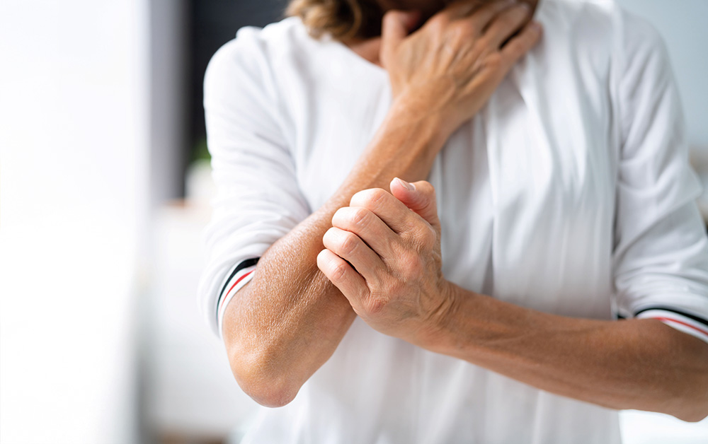 Rätselhafter Juckreiz? Es könnte Prurigo nodularis sein