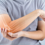 Osteoporose: Symptome, Ursachen & 4 Tipps für starke Knochen